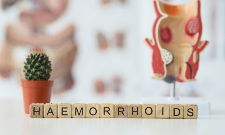 Hemorroida Estourou? O Que Fazer e Como Tratar de Forma Segura?
