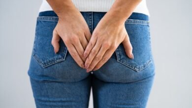 Plicoma Anal: É necessário Fazer Cirurgia?